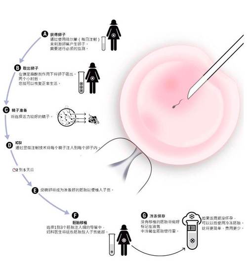 找人试管代怀是真的吗-试管代怀是真的吗？找人代孕真的可靠吗？