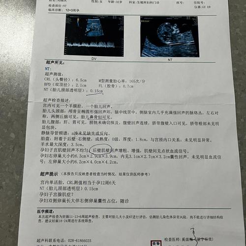 处女能试管代怀吗(处女能试管代怀吗？解密处女试管代孕的可能性)